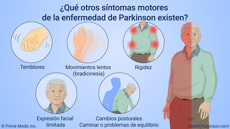 Entendiendo La Enfermedad De Parkinson 0041
